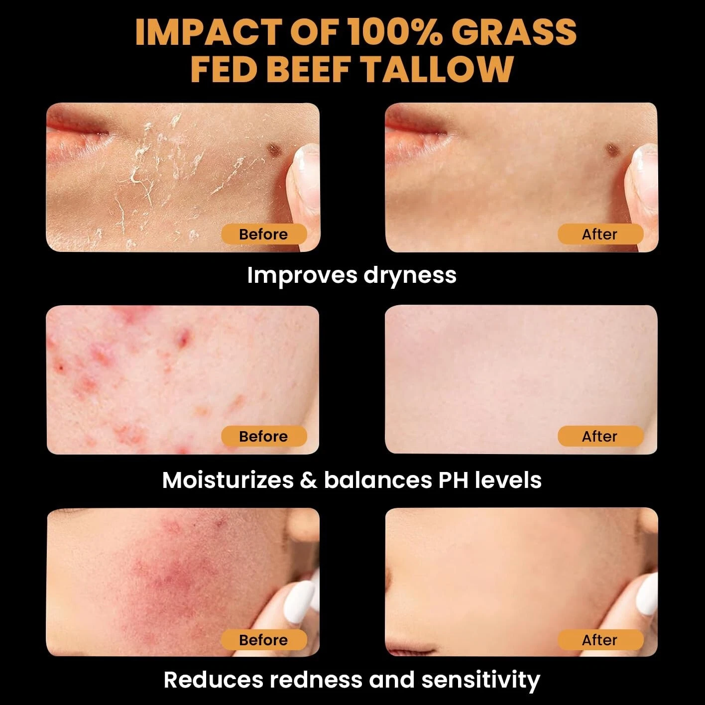 Organic Grass-Fed Beef Tallow Balm with Raw Honey - Moisturizing Cream for Soft, Smooth Skin - Handmade All-Natural Moisturizer 57g