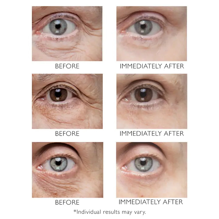 Peter Thomas Roth Instant FirmX Eye 30ml
