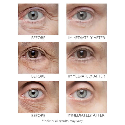 Peter Thomas Roth Instant FirmX Eye 30ml