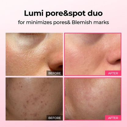 Lumi Pore & Spot Care Duo
